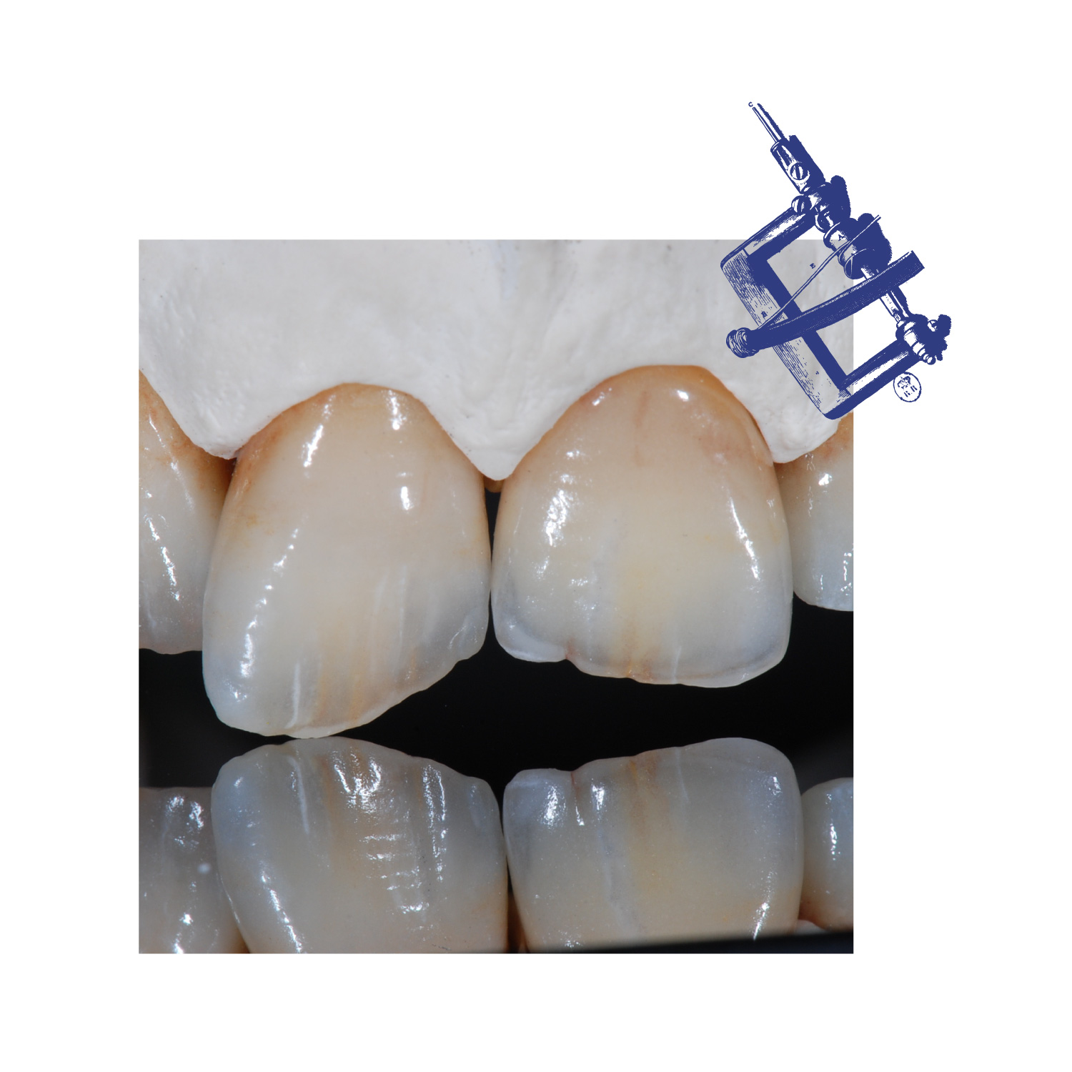 catterini-dentaltech-sa-lugano-design-diego-cinquegrana-aimaproject-sa-tavola-5-new